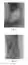 Fig. 03 - Use of pharmaceutical compositions in preparing pharmaceuticals for treating diabetic ulcer