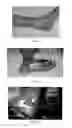 Fig. 05 - Use of pharmaceutical compositions in preparing pharmaceuticals for treating diabetic ulcer