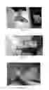 Fig. 06 - Use of pharmaceutical compositions in preparing pharmaceuticals for treating diabetic ulcer