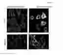 Fig. 03 - Detection and treatment of cancer