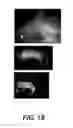 Fig. 93 - Levels and/or Sustainability of DNA-based Gene Expression