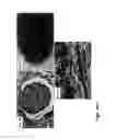 Fig. 05 - Medium comprising transforming growth factor beta 1 and basic fibroblast growth factor