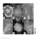 Fig. 11 - Medium comprising transforming growth factor beta 1 and basic fibroblast growth factor