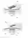 Fig. 06 - ABDOMINAL ROCKING EXERCISE APPARATUS