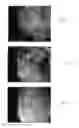 Fig. 02 - Materials and methods for treatment and diagnosis of disorders associated with oxidative stress