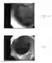 Fig. 03 - Materials and methods for treatment and diagnosis of disorders associated with oxidative stress