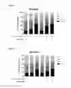 Fig. 32 - Pyrimidine hydroxy amide compounds as histone deacetylase inhibitors