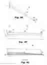 Fig. 05 - Implantable support with dilator attached to arm