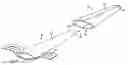 Fig. 01 - Systems, implants, tools, and methods for treatments of pelvic conditions