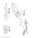 Fig. 02 - Systems, implants, tools, and methods for treatments of pelvic conditions