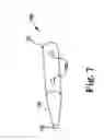 Fig. 08 - Systems, implants, tools, and methods for treatments of pelvic conditions