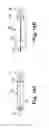 Fig. 16 - Systems, implants, tools, and methods for treatments of pelvic conditions