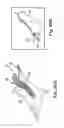 Fig. 19 - Systems, implants, tools, and methods for treatments of pelvic conditions