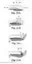 Fig. 20 - Systems, implants, tools, and methods for treatments of pelvic conditions