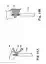 Fig. 23 - Systems, implants, tools, and methods for treatments of pelvic conditions