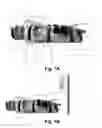 Fig. 02 - NEONATE'S IMMOBILIZING RESTRAINER