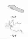 Fig. 03 - NEONATE'S IMMOBILIZING RESTRAINER