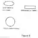 Fig. 03 - Method and kit for treatment of dysphagia