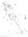 Fig. 08 - Biopsy device