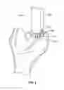 Fig. 02 - Instruments, Methods and Systems for Harvesting and Implanting Graft Materials