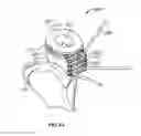 Fig. 45 - Instruments, Methods and Systems for Harvesting and Implanting Graft Materials