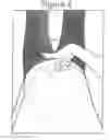 Fig. 06 - APPARATUS AND METHOD FOR DETECTING DIASTASIS RECTI