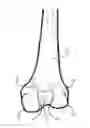 Fig. 01 - METHOD FOR KNEE RESECTION ALIGNMENT APPROXIMATION IN KNEE REPLACEMENT PROCEDURES