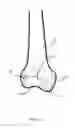 Fig. 03 - METHOD FOR KNEE RESECTION ALIGNMENT APPROXIMATION IN KNEE REPLACEMENT PROCEDURES
