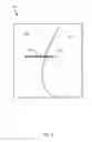 Fig. 08 - METHOD FOR KNEE RESECTION ALIGNMENT APPROXIMATION IN KNEE REPLACEMENT PROCEDURES