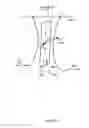Fig. 16 - METHOD FOR KNEE RESECTION ALIGNMENT APPROXIMATION IN KNEE REPLACEMENT PROCEDURES