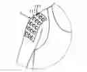 Fig. 01 - STRAP STICKER FOR BODY ADHESION