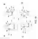 Fig. 07 - UPPER BODY POSTURE CORRECTOR ASSEMBLY