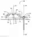 Fig. 01 - Therapeutic agent injection device