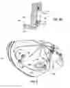 Fig. 09 - Surgical waste collection unit with a manifold receiver that is offset relative to the horizontal