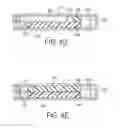 Fig. 04 - Multiple reservoir drug delivery device and methods