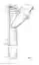 Fig. 07 - Cyst extractor