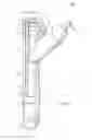 Fig. 09 - Cyst extractor