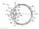 Fig. 01 - METHOD AND SYSTEM FOR ADJUSTING THE REFRACTIVE POWER OF AN IMPLANTED INTRAOCULAR LENS