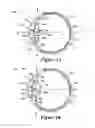 Fig. 02 - METHOD AND SYSTEM FOR ADJUSTING THE REFRACTIVE POWER OF AN IMPLANTED INTRAOCULAR LENS