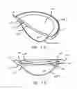 Fig. 09 - METHOD AND SYSTEM FOR ADJUSTING THE REFRACTIVE POWER OF AN IMPLANTED INTRAOCULAR LENS