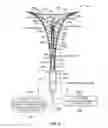 Fig. 07 - SYSTEM AND METHOD FOR ENDOMETRIAL ABLATION