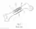 Fig. 03 - BONE FIXATION PLATE