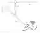 Fig. 01 - Patient-specific total hip arthroplasty