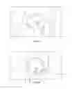 Fig. 06 - Patient-specific total hip arthroplasty
