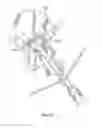 Fig. 16 - Patient-specific total hip arthroplasty