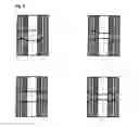 Fig. 04 - Robotic surgery system and surgical instrument