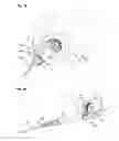 Fig. 12 - Robotic surgery system and surgical instrument
