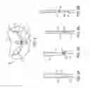 Fig. 05 - Gripper pusher mechanism for tissue apposition systems