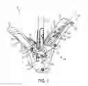 Fig. 06 - Gripper pusher mechanism for tissue apposition systems