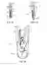Fig. 09 - Gripper pusher mechanism for tissue apposition systems